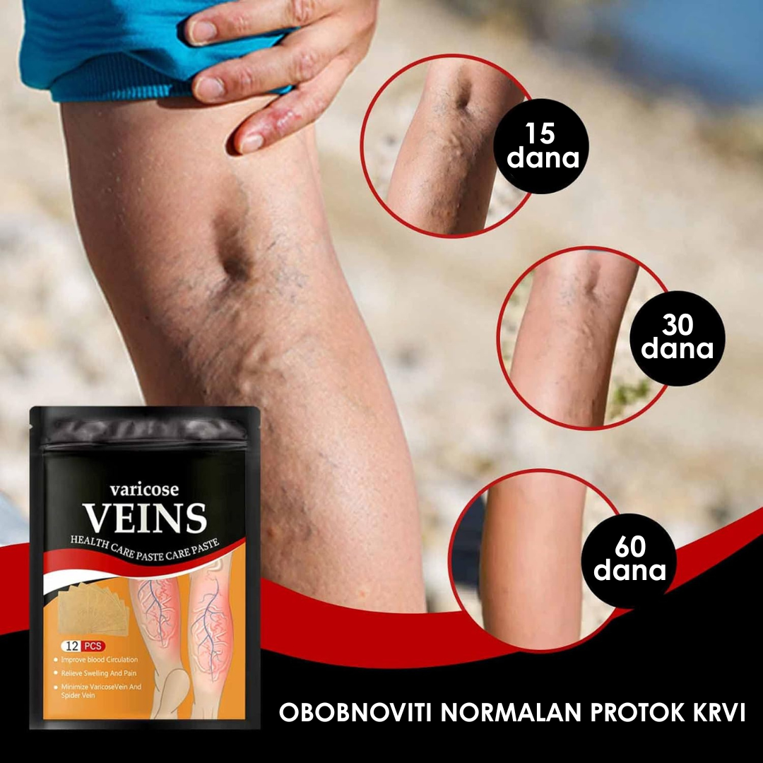 Flasteri Za Olakšanje Otečenim i Umornim Nogama (12 Komada)